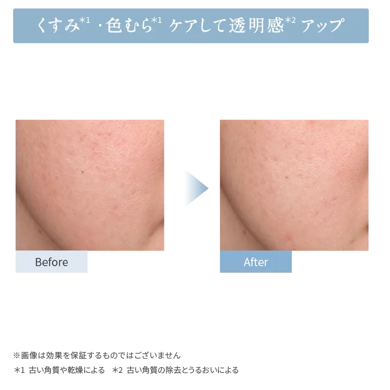 くすみ、色むらをケアして透明感アップ