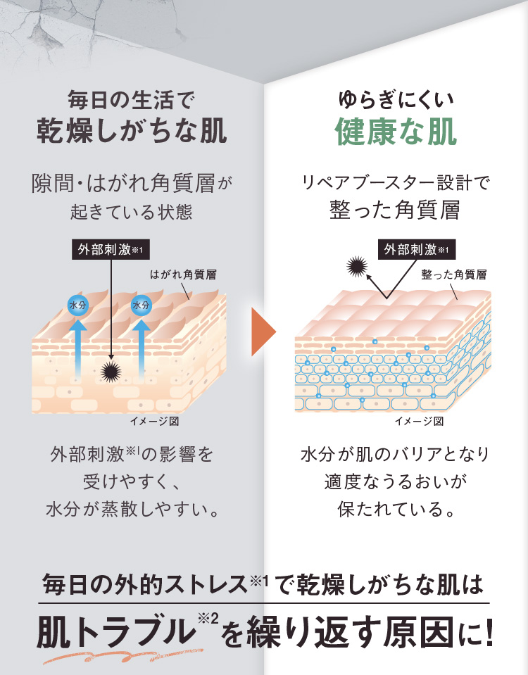 毎日の外的ストレスで乾燥しがちな肌は肌トラブルを繰り返す原因に!